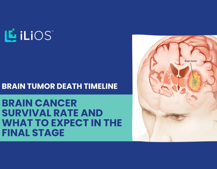 Brain Tumor Death Timeline