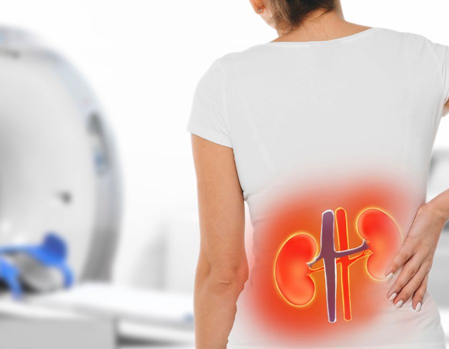 What Is the Latest Treatment for Chronic Kidney Disease
