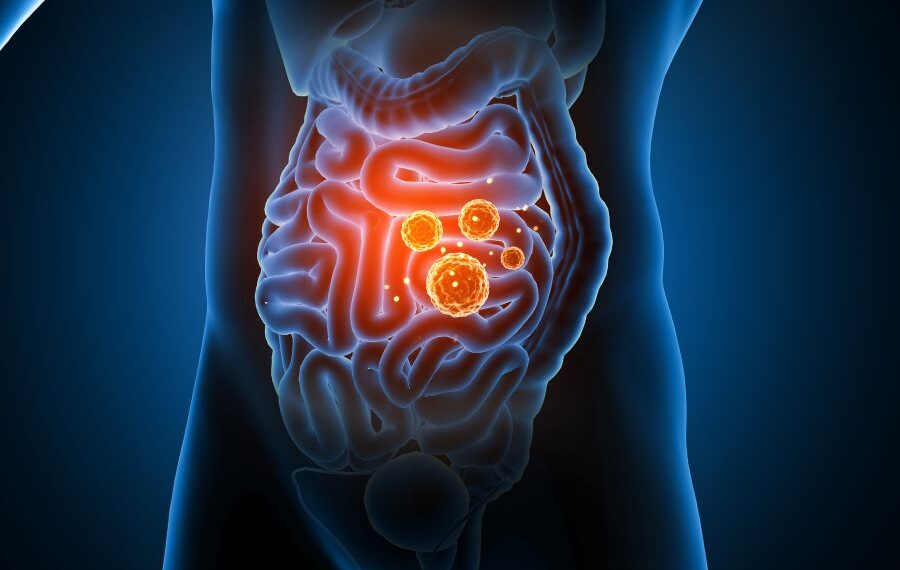 how to increase good bacteria in gut naturally